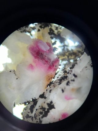 fungus under microscope