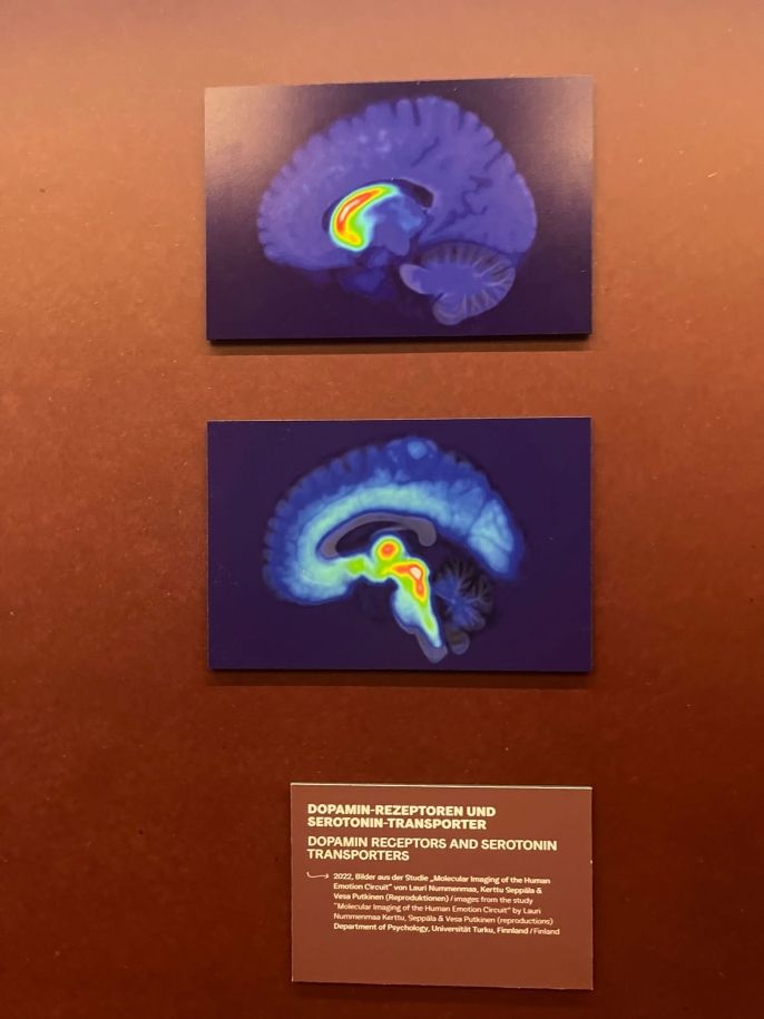 Hello Happiness brain scan